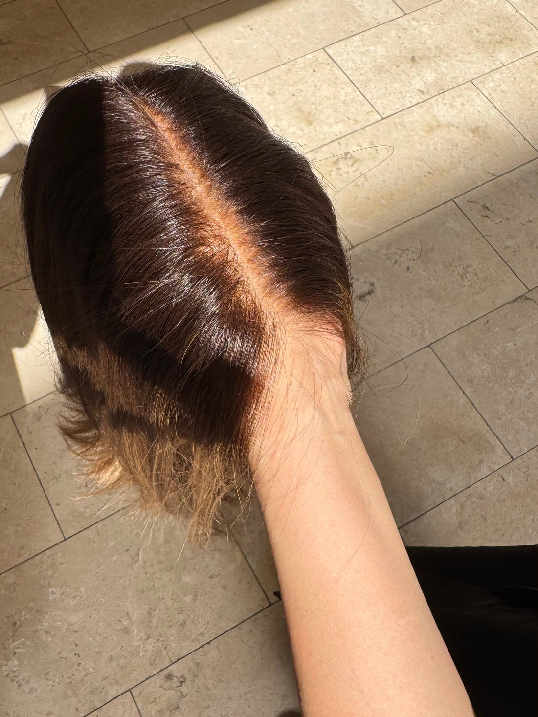 How to Spot a Good Hairline