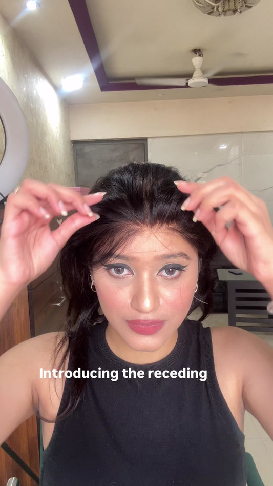 Receding Hairline Fix Topper